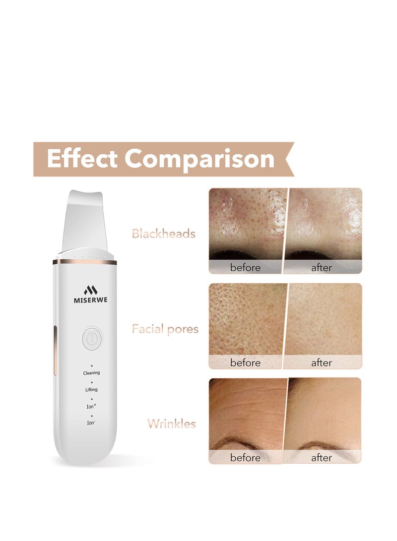 Miserwe Skin Scrubber Face Skin Spatula Facial Scrubber Spatula for Deep Cleansing Blackhead Remover Pore Cleaner with 4 Modes (White) - Image 3
