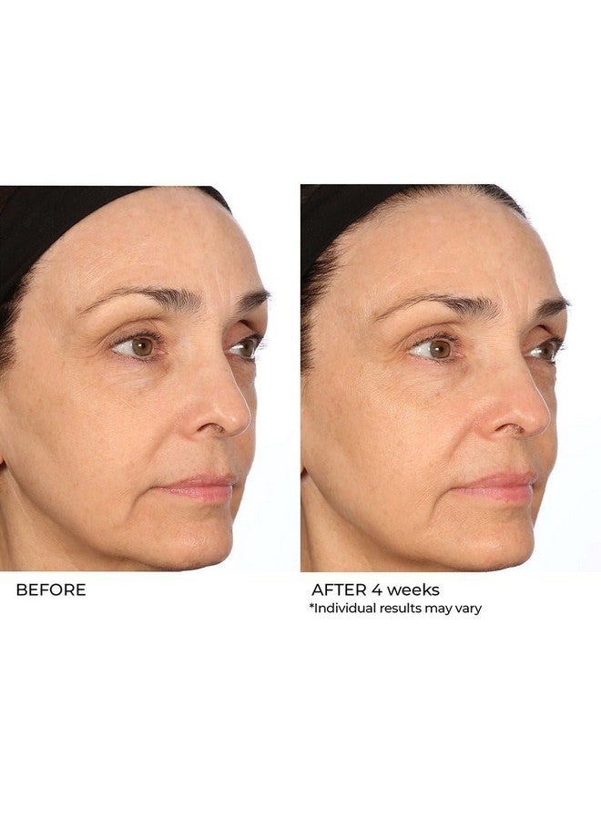 nassif md Nassifmd Pro Peptide Collagen Serum Peptide Serum Textured Skin Treatment Fine Lines And Wrinkles Treatment Anti Aging Serum Firms And Smooths Skin - Image 4