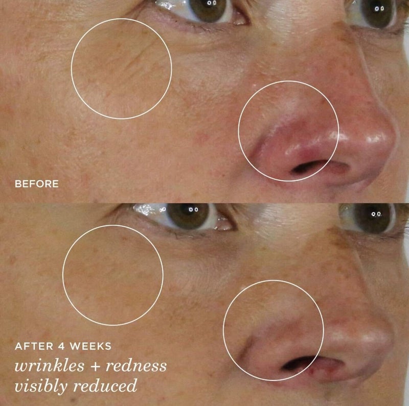 Tatcha The Silk Serum Wrinkle-Smoothing Retinol Alternative | 30 ml / 1 oz - Image 4