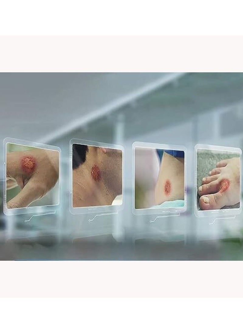 Ring Guard - Anti-Fungal Cream Treatment for Ringworm - 20 g - Image 1
