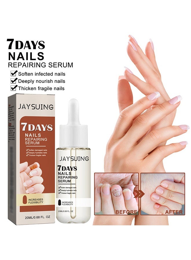 7 Days Nails Repairing Serum Nail Repair Oil For Damaged And Brittle Nails Promotes Faster Nail Growth And Strengthens Nails Transparent Treatment 20Ml
