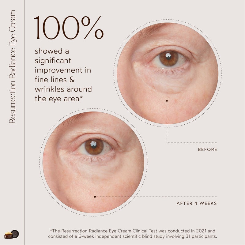 True Botanicals Resurrection Radiance Brightening Eye Cream | Reduces Appearance of Dark Circles, Fine Lines, Wrinkles & Puffiness | Dermatologist Tested, All Natural, Vegan| 0.5 oz | 15 ml - Image 2