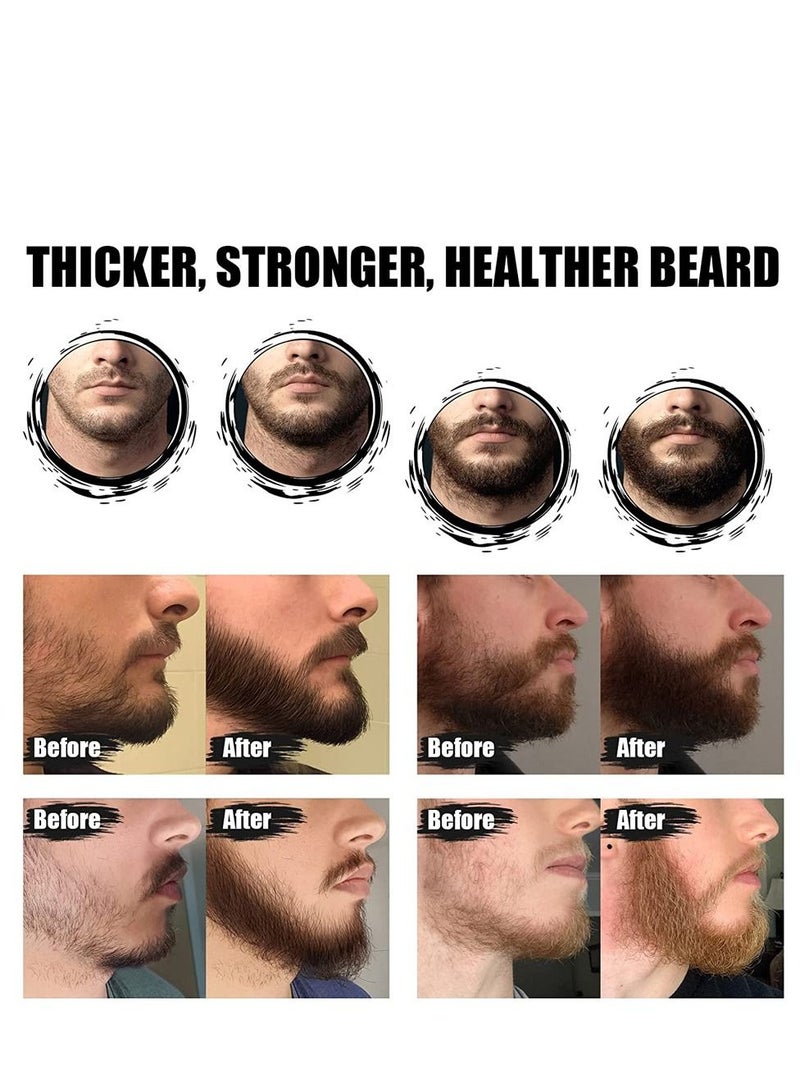 Beard OIL Beard Growth Kit, Beard Roller Kit, Natural Beard Growth Oil for Patchy Beard, Beard & Mustache Facial Hair Growth, Beard Oil, Beard Balm, Beard Roller, Brush, Comb, Storage Bag, Gifts for Men - Image 4
