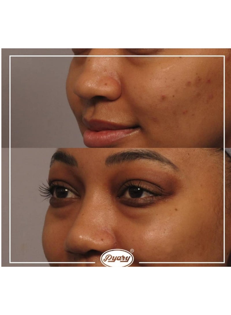 بياري صابون كركم 75 جرام - Image 4