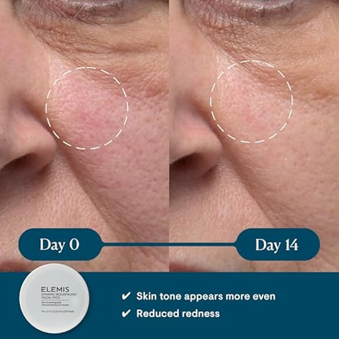 ELEMIS Dynamic Resurfacing Facial Pads, Gentle Textured Treatment Facial Exfoliating Pads - Image 2