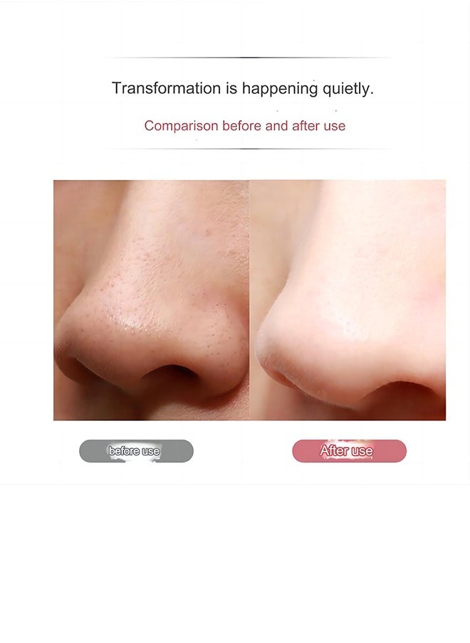 Generic - Skin Cleaner Facial Scraper, Skin Scraper Pore Cleaner Blackhead Removal Tool for Facial Deep Cleansing - 3 Modes, White - Image 1