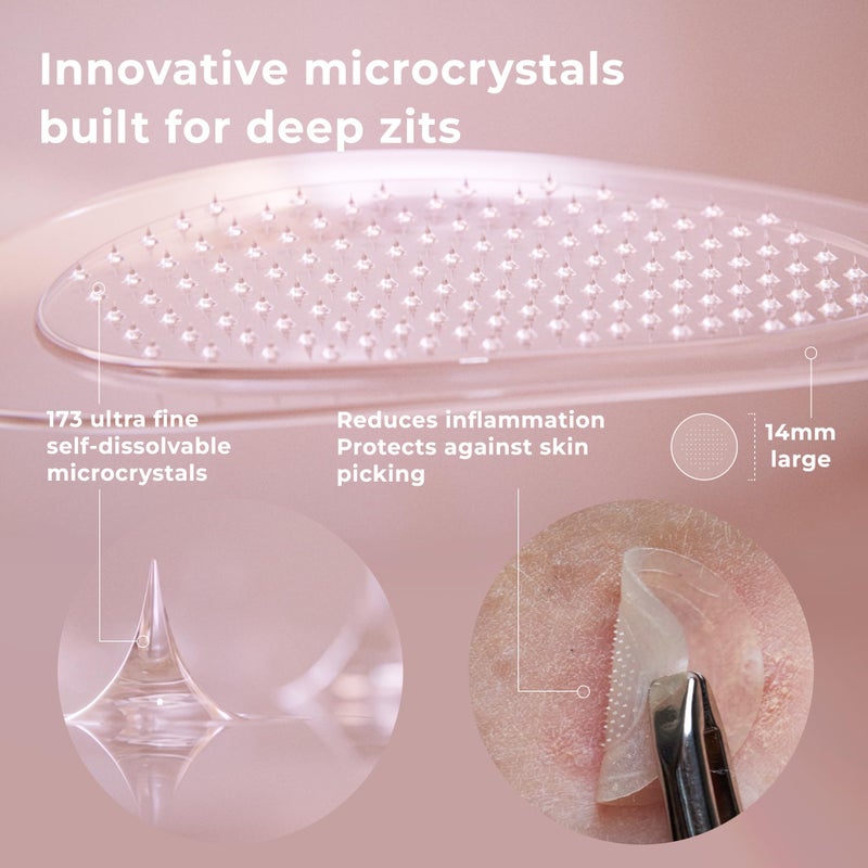 OMMA Korean Microdart Acne Patch | Efficient Cystic Acne Overnight Treatment | Micropoint Pimple Patches for Face for Early-Stage Painful Zits with Salicylic Acid & Tea Tree | 18 (14mm) Zit Stickers - Image 5