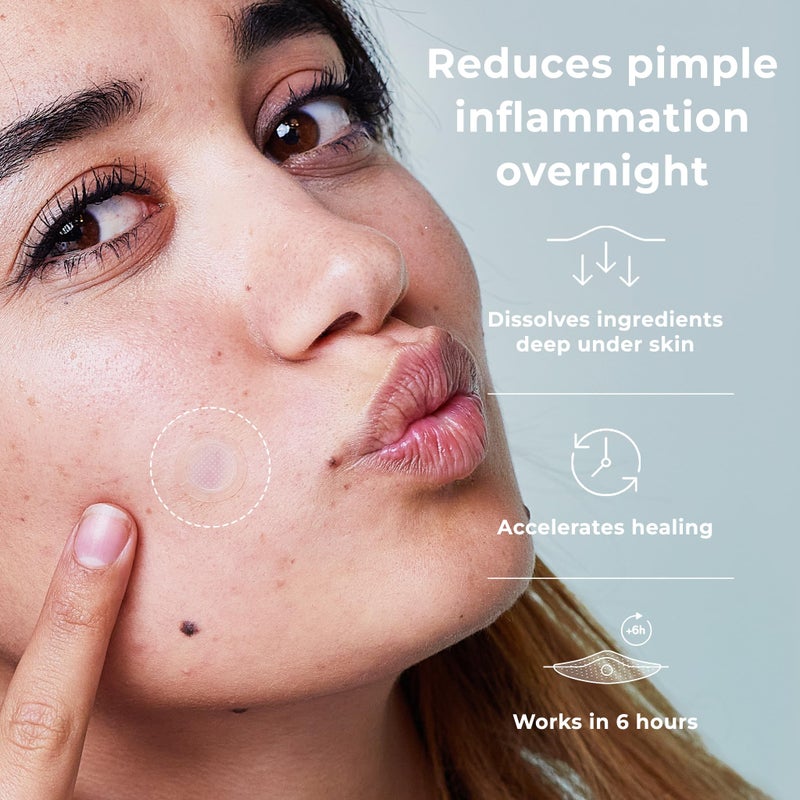 OMMA Korean Microdart Acne Patch | Efficient Cystic Acne Overnight Treatment | Micropoint Pimple Patches for Face for Early-Stage Painful Zits with Salicylic Acid & Tea Tree | 18 (14mm) Zit Stickers - Image 3