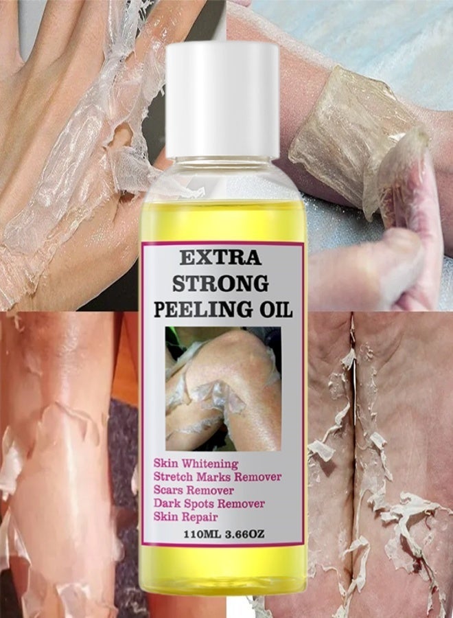 MOOYAM Extra Strong Peeling Oil, Yellow Peeling Oil For Dark Skin, Natural Formula Exfoliating Peels Solution For Face, Body, Hands And Foot Dead Skin Remover (110ML/3.66 OZ) - Image 1
