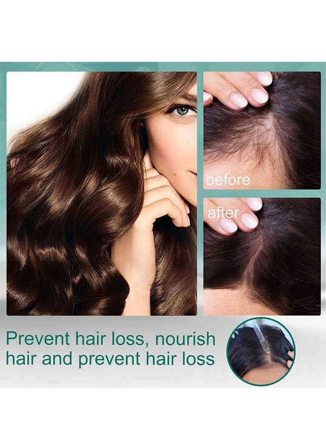 EELHOE - Natural Essence Ginger Hair Nutrition Solution 30ml, Has The Effect Of Slows Hair Loss, Restores Hair Shine And Vitality, Stimulates Hair Growth, Suitable For All Scalp Uses - Image 1