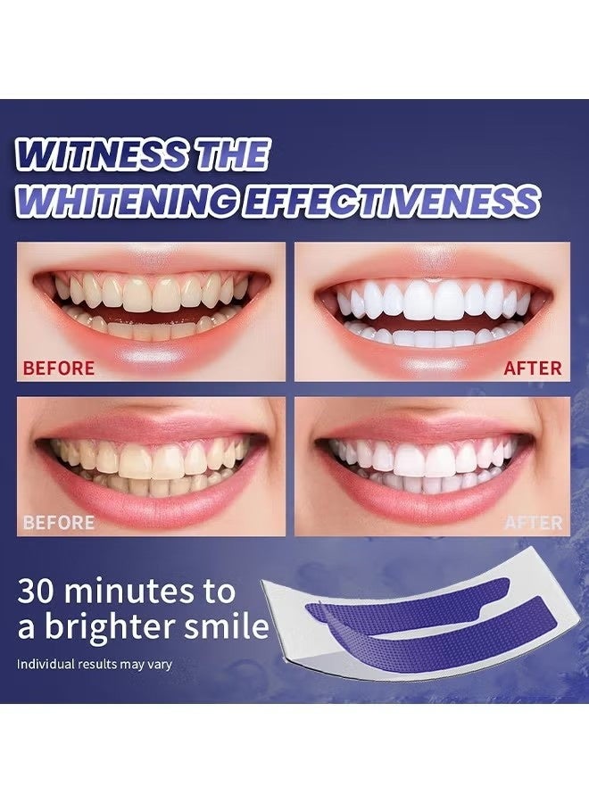 IVISMILE Purple Instant Whitening Strips, V34 Teeth Whitening Strips, Purple Tooth Whitening, Tooth Stain Treatment, Gum Care&Stain Removal, Removes Yellow Stains&Bad Breath, Combining Whitening And Colour Correction 14 Treatments - Image 4