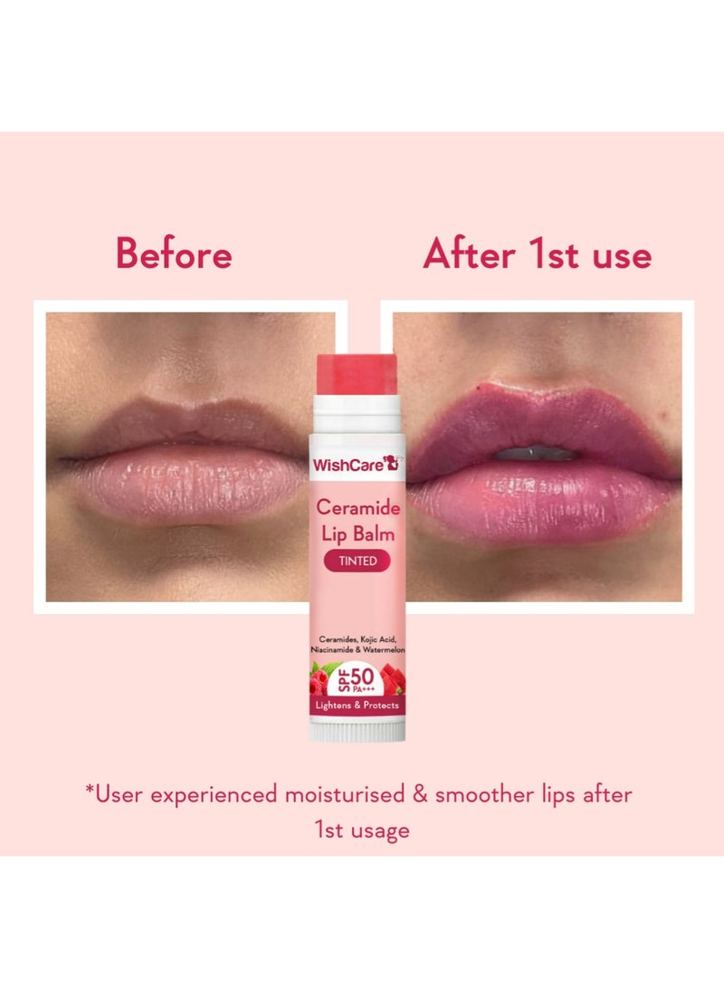WishCare مرطب شفاه سيراميد ملون مع عامل حماية من الشمس 50 PA+++ - حمض الكوجيك والنياسيناميد - لتفتيح الشفاه وحمايتها 5 جم - Image 4