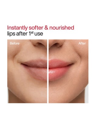Tinted Lip Balm with SPF 50 PA+++ | Brightening Lip Balm for Dark Lips | Kojic Acid & Niacinamide | For Women - view 5