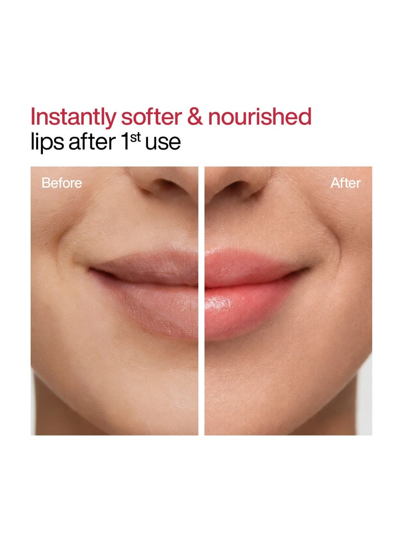 WishCare Tinted Lip Balm with SPF 50 PA+++ | Brightening Lip Balm for Dark Lips | Kojic Acid & Niacinamide | For Women - Image 5