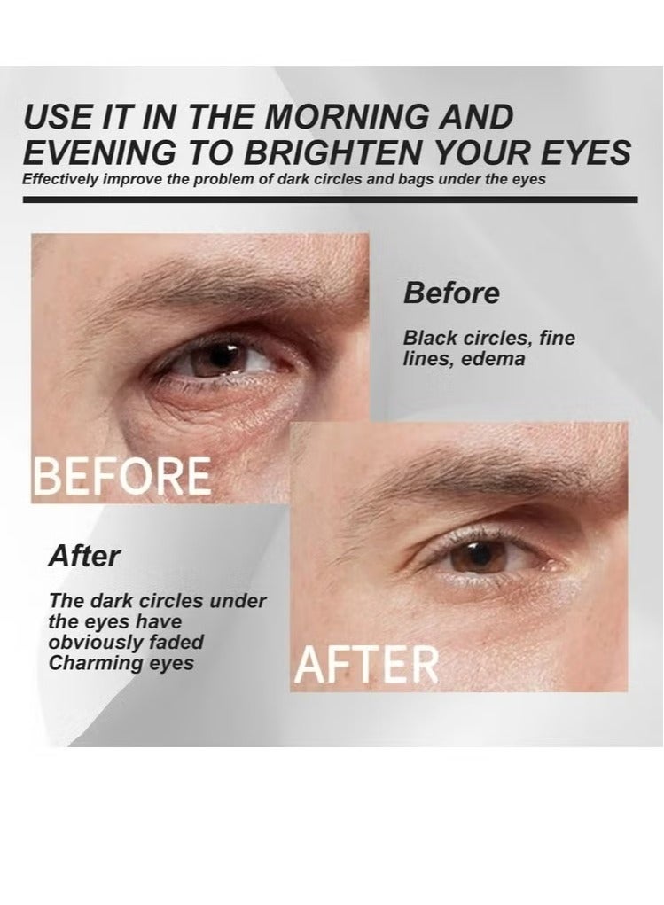 EELHOE Mens Eye Cream, Eye Cream for Dark Circles and Puffiness, Anti-aging Caffeine Eye Cream for Men, Brightens, Reduces Puffiness, Dark Circles, and Fine Lines, Eye Treatment for Men - Image 4