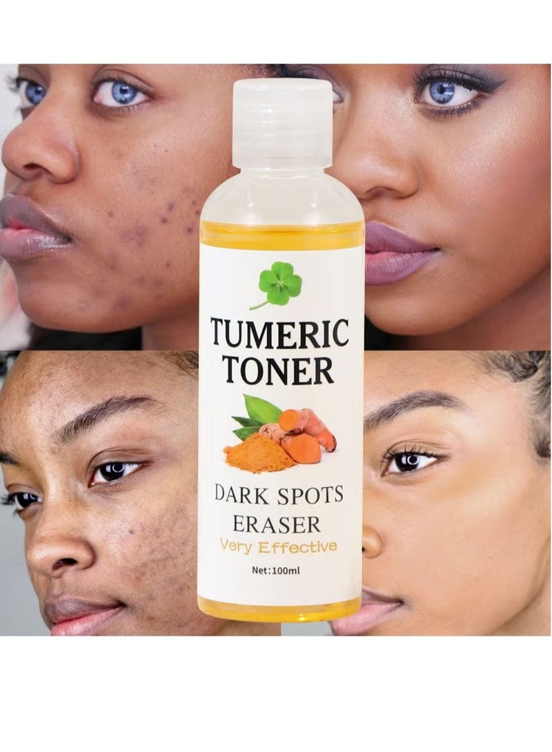 Turmeric Dark Spot Correcting Toner 100ml for Face Brightening Treatment Reduces Hyperpigmentation and Acne Blemishes Hydrates and Improves Skin Tone for All Skin Types