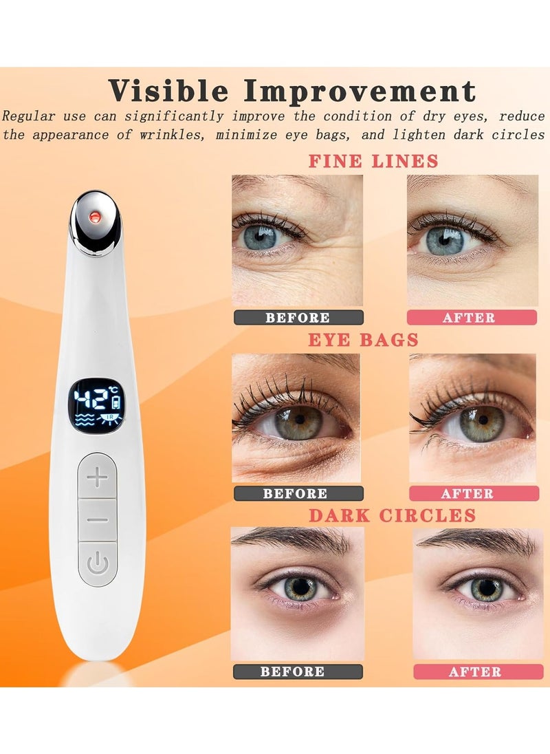 General - Eye Lift Wand, 3 in 1 Vibrating 98°F to 113°F LCD Display Screen Eye Massager for Dry Eyes, Dark Circles and Puffiness, Fine Lines and Wrinkles, Cream White - Image 1