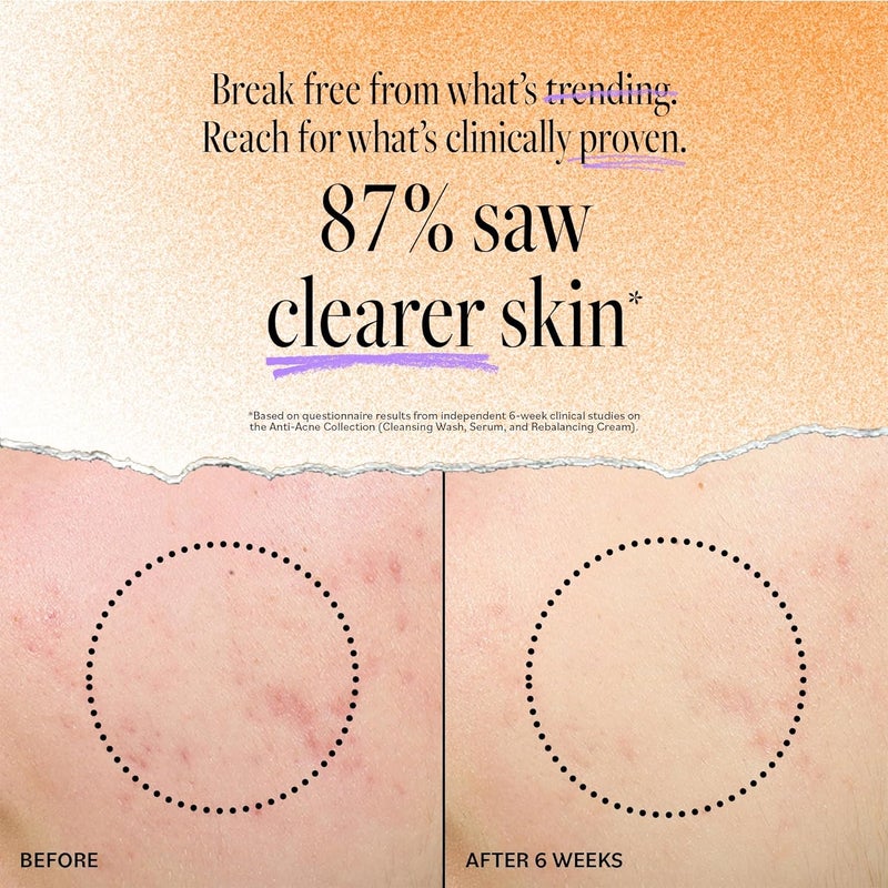 derma-e Derma E Acne Deep Pore Cleansing Wash with 2% Salicylic Acid, Tea Tree Oil & Chamomile - 6 Fl Oz (175 mL) - Image 3