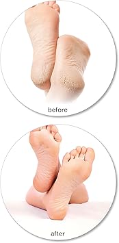 RIO ريو 60 ثانية بيدي وإزالة الجلد الصلب مبرد القدم - Image 4