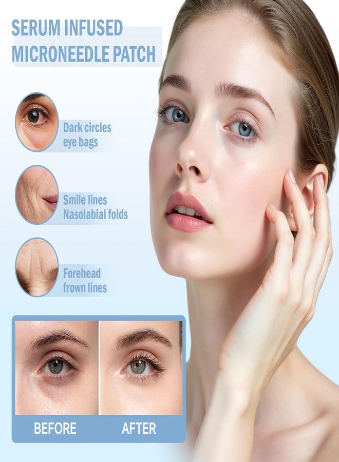 Dissolvable Microneedle Eye Patches for Dark Circles | 1 Pair | Under Eye Mask with Hyaluronic Acid & Retinol | Needle-Free Treatment for Puffiness & Fine Lines - Image 2