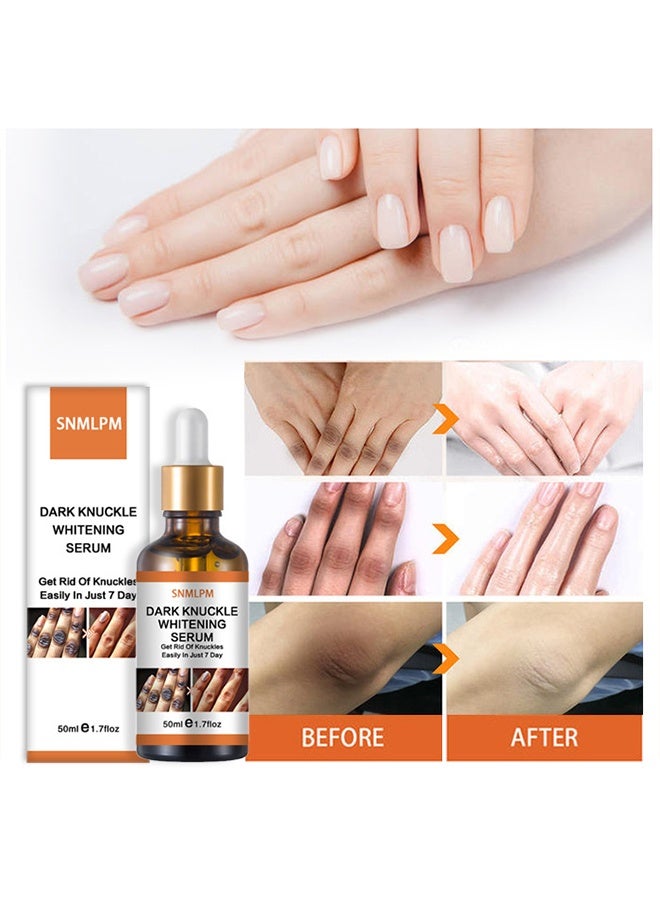 سنملبم مصل تبييض المفصل الداكن - علاج 7 أيام للبقع الداكنة في اليدين والقدمين مقشر مفاصل يحسن البهتان تأثير تبييض قوي للرجال والنساء 50 مل - Image 2