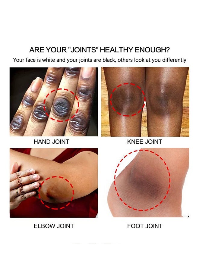 سنملبم مصل تبييض المفصل الداكن - علاج 7 أيام للبقع الداكنة في اليدين والقدمين مقشر مفاصل يحسن البهتان تأثير تبييض قوي للرجال والنساء 50 مل - Image 4
