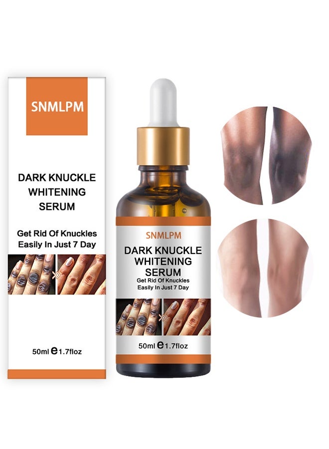 سنملبم مصل تبييض المفصل الداكن - علاج 7 أيام للبقع الداكنة في اليدين والقدمين مقشر مفاصل يحسن البهتان تأثير تبييض قوي للرجال والنساء 50 مل - Image 1