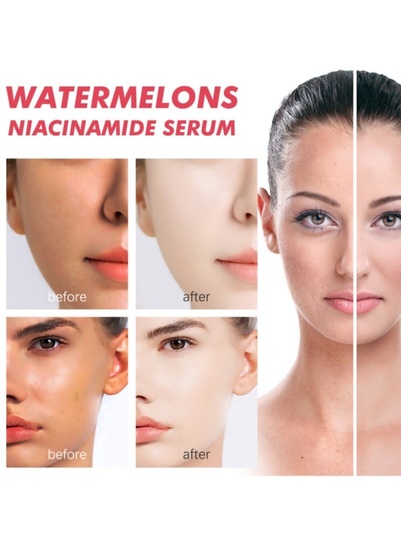 إيلهو سيروم قطرات الندى من نياسيناميد البطيخ 60 مل - Image 3