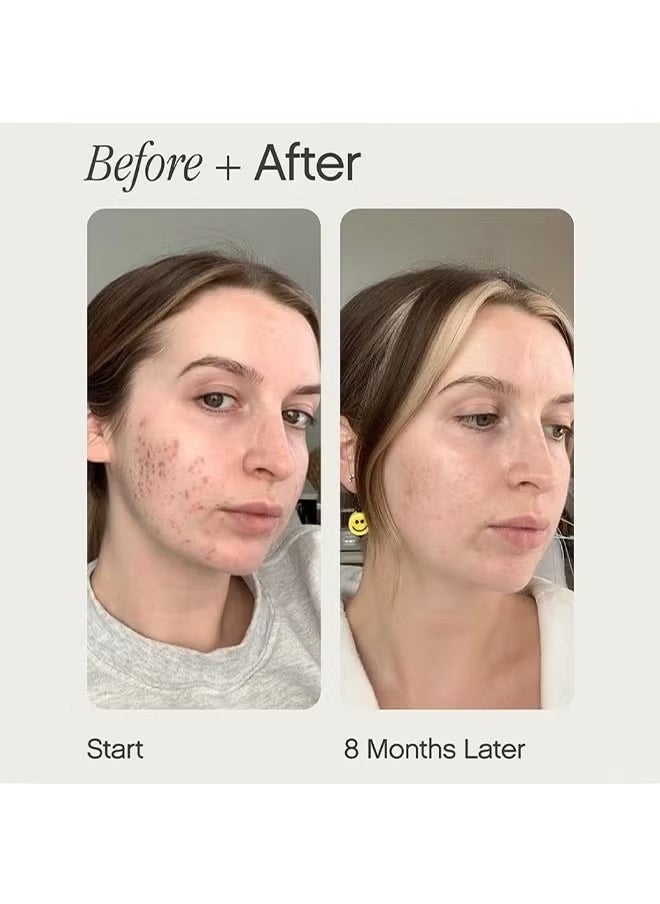 TOPICALS Topicals Brightening and Clearing Serum | Reduces Discoloration, Post-Blemish Marks, Scars and Spots | Contains Kojic Acid and Niacinamide | Dermatologist-tested, Vegan, Cruelty-Free (50ml/1.7 Fl Oz)  - Image 3