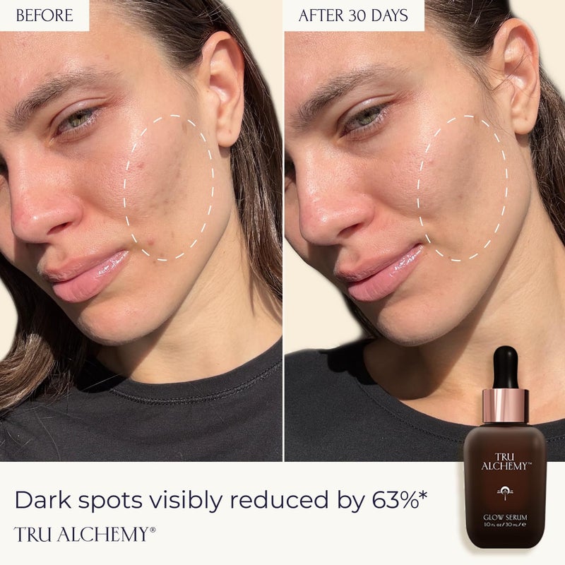 Tru Alchemy Vitamin C Glow Serum - Hydrating Anti-Aging Vitamin C Face Serum with Bakuchiol, Glycolic & Lactic Acid, 1 fl oz. - Image 2