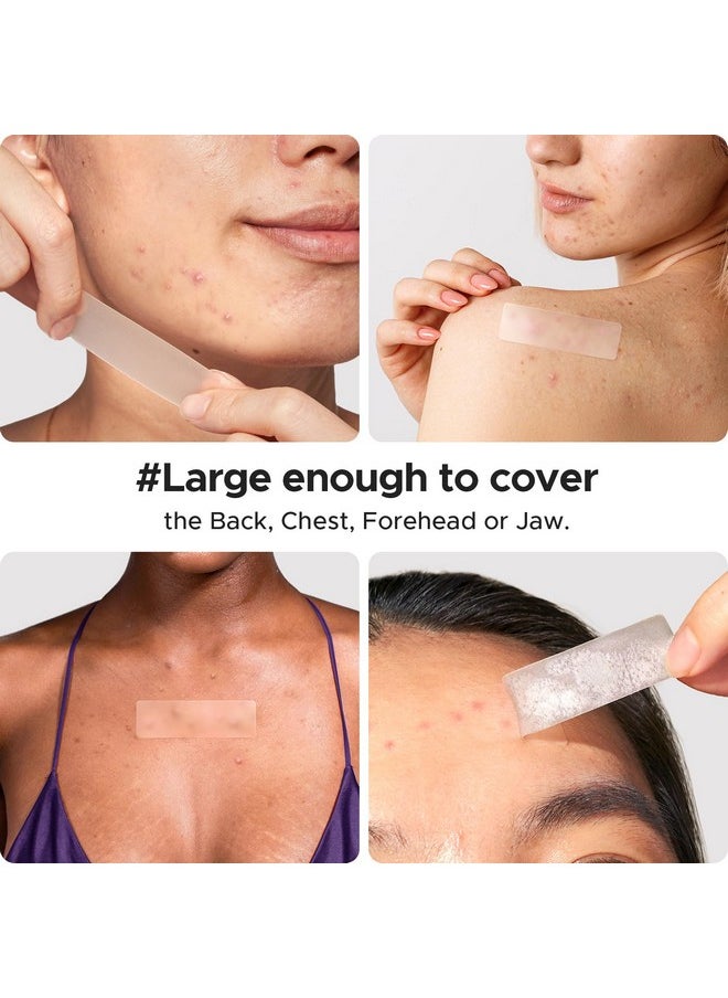 LitBear LitBear Large Pimple Patches for Face (4 Sizes 80 Patches), Big Acne Patches, XL Hydrocolloid Bandages Strips for Body, Forehead, Cheek, Chin, Butt, Back & Chest, Rectangle hydrocolloid Patch  - Image 3