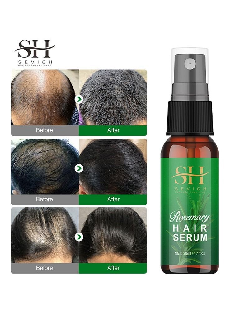 Sevich - Rosemary Serum for Hair Growth Hair Loss Regrowth Treatment Strengthens Hair Nourishes Scalp Light Weight No Greasy Improves Scalp Circulation for Men & Women 30ml - Image 1