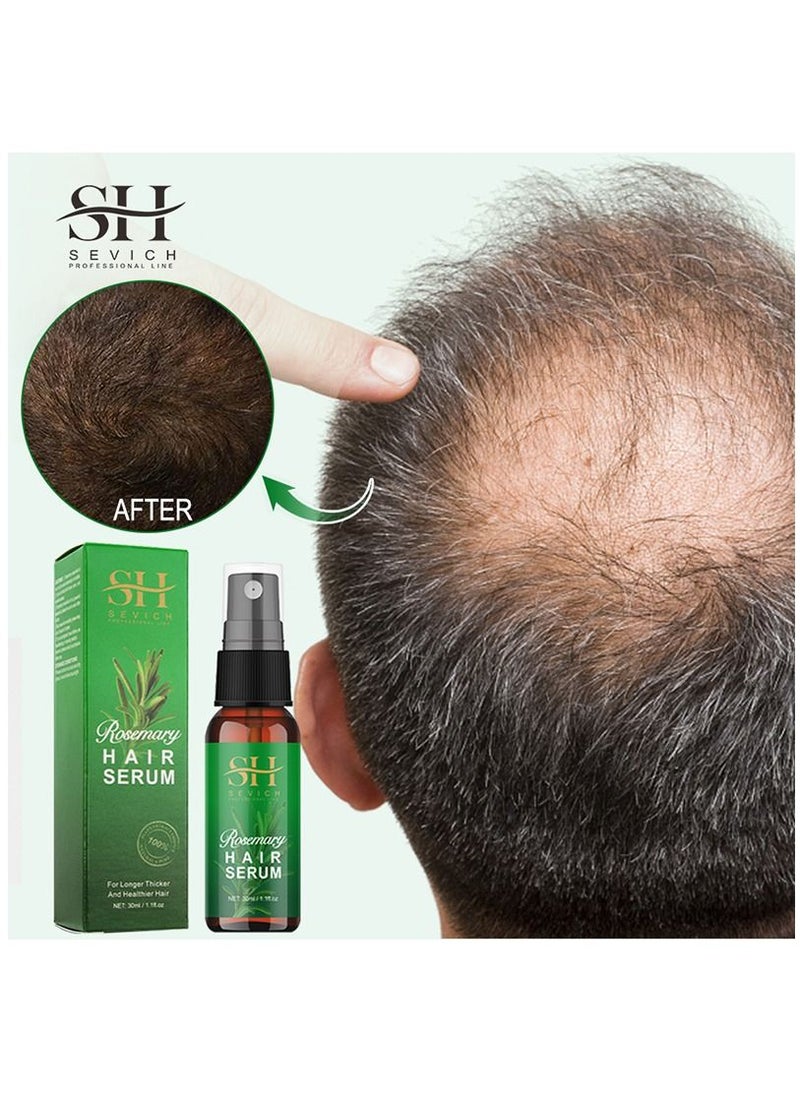 Sevich - Rosemary Serum for Hair Growth Hair Loss Regrowth Treatment Strengthens Hair Nourishes Scalp Light Weight No Greasy Improves Scalp Circulation for Men & Women 30ml - Image 1