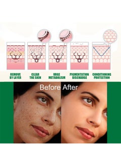 EELHOE Dark Spot Correcting Glow Serum, Moisturizing Whitening Brightening Serum, Dark Spot Treatment, Repair Dullness, for Acne Scars, Fine Lines, Hyperpigmentation and Dark Circles 50ml  - Image 3