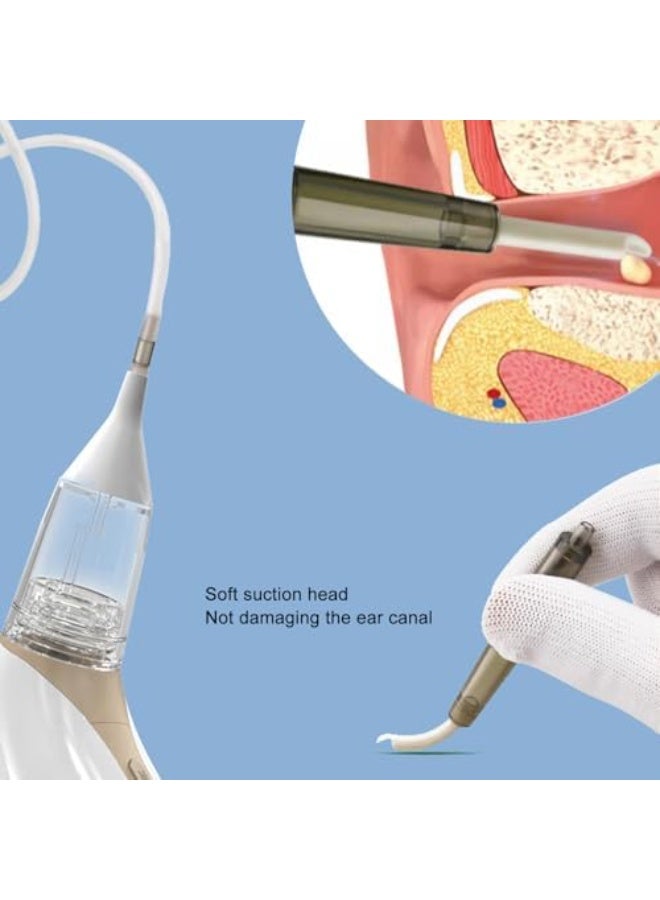 L LULONG Earwax Remover, Electric Ear Suction Cleaner, 3 Levels of Suction, Low Noise, Rechargeable, Detachable Earwax Removal Set, Ear Pressure Head, Portable Ear Liquid Collection Tool - Image 3