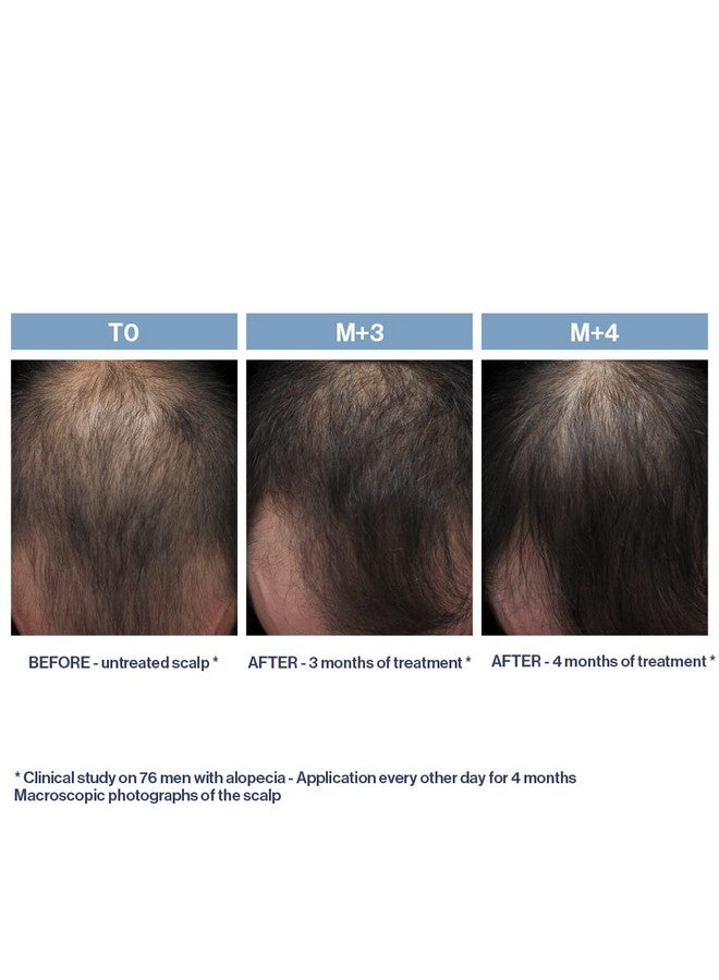 Phyto Paris Phytolium+ Treatment, 3.38 Fl. Oz. - Image 3