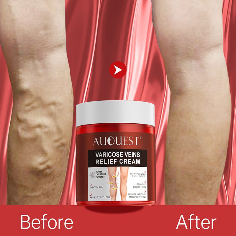 Auquest Spot Wholesale Varicose Cream Leg Blood Vessels Protruding Calf Swelling Centipede Leg Varicose Cream(80) - Image 1