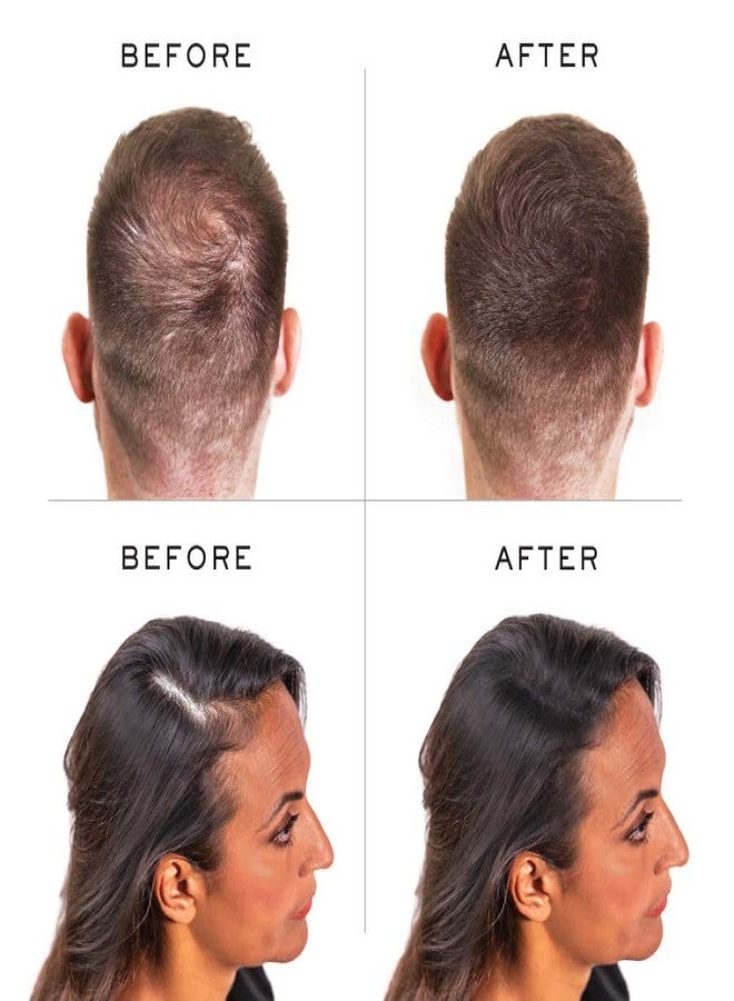 Nanogen Keratin Hair Thickening Fibers (15 gm, Grey, 2) - Image 3