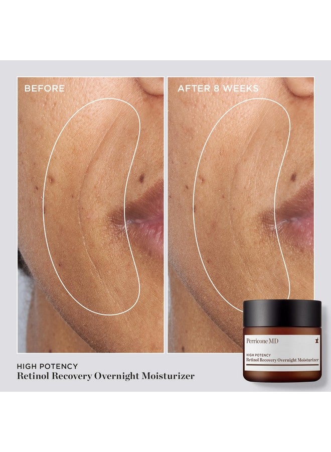 Perricone MD High Potency Retinol Recovery Overnight Moisturizer, 2 fl. oz. - Image 3