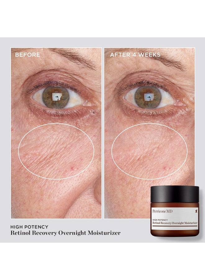 Perricone MD High Potency Retinol Recovery Overnight Moisturizer, 2 fl. oz. - Image 4