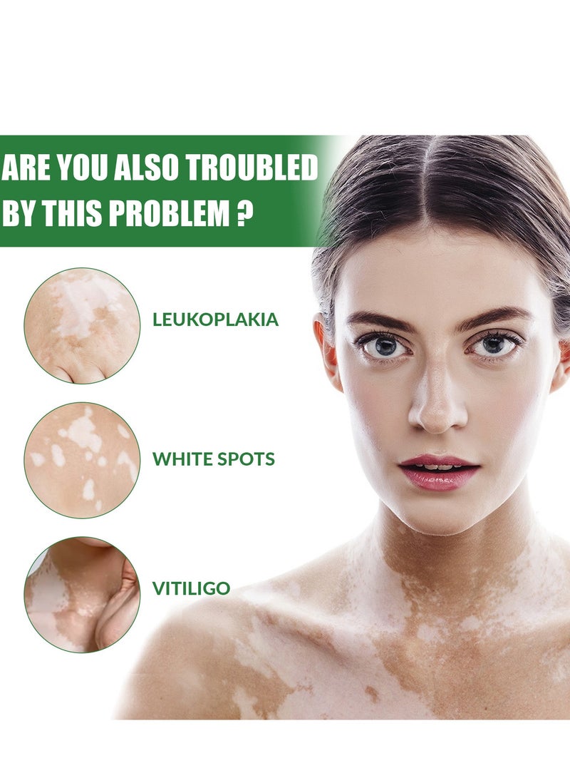EELHOE Vitiligo Repair and Revitalizing Cream, Vitiligo Treatment Soothing Cream, Vitiligo Treatment Cream, Effectively Improve Skin Pigmentation and Lighten Vitiligo, Reduce White Spots 15g - Image 4