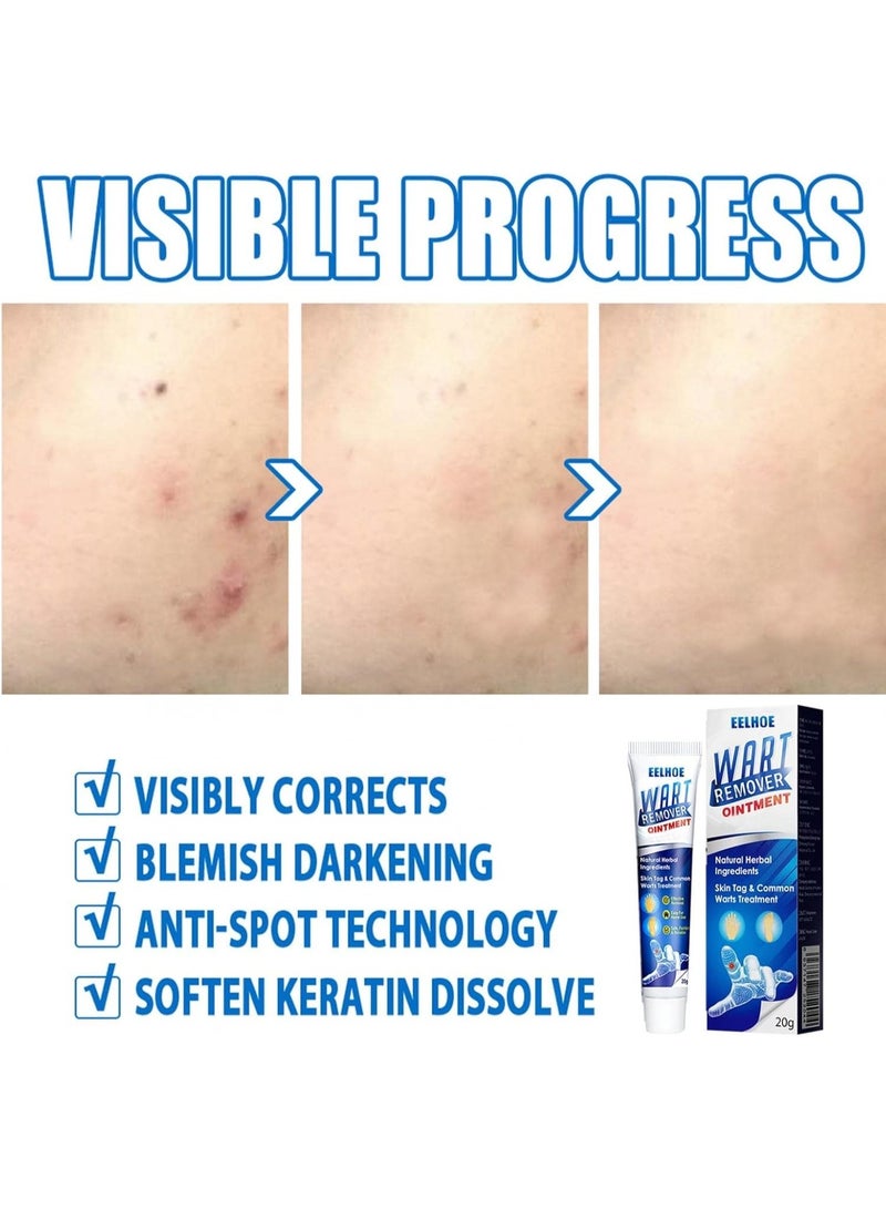 إيلهو مرهم مزيل الثآليل اللطيف لإزالة علامات الجلد وإصلاحها، تركيبة طبيعية سريعة المفعول، علاج آمن وفعال لإزالة الثآليل - Image 4