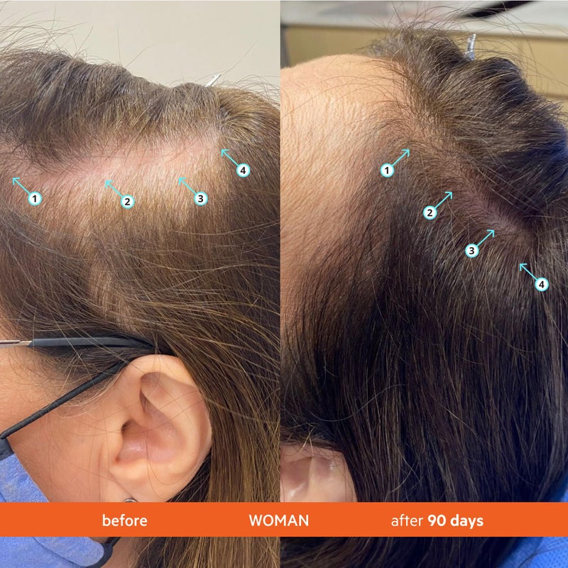 DS LABORATORIES مجموعة شامبو وبلسم ريفيتا من دي إس لابوراتوريز - شامبو وبلسم لنمو الشعر، شامبو وبلسم لتكثيف الشعر للشعر الرقيق، علاج تساقط الشعر مانع DHT للنساء والرجال - Image 5