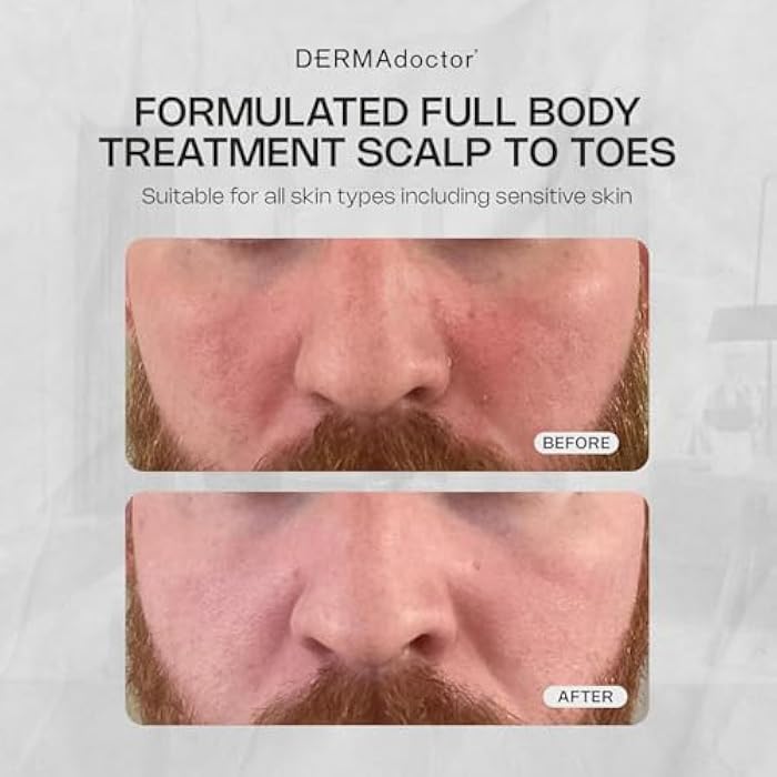 DERMAdoctor Seborrheic Dermatitis Face Wash – 2% Pyrithione Zinc Shampoo Dermatologist Formulated Dandruff Scalp Treatment – Pyrithione Zinc Face Wash and Body Cleanser for Sensitive Skin – 7.10 oz - Image 3