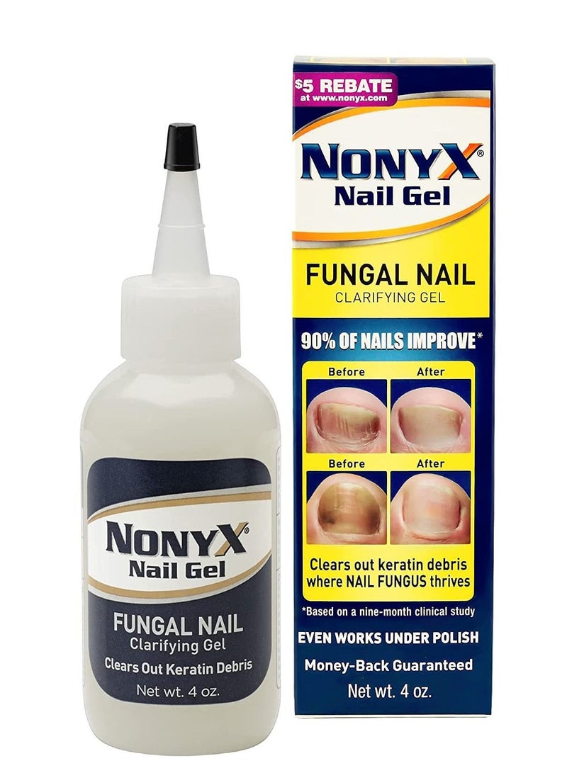 Nonyx Fungal Nail Clarifying Gel Clears Out Keratin Debris  4oz - Image 1