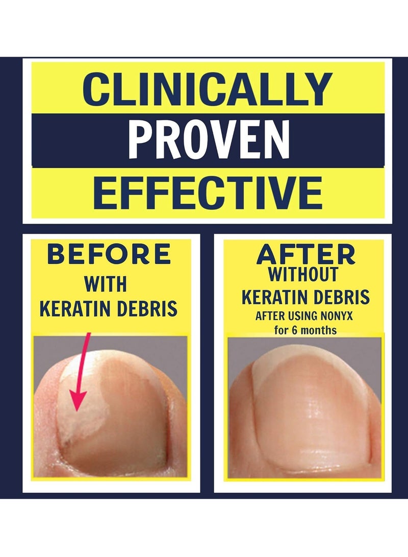 Nonyx Fungal Nail Clarifying Gel Clears Out Keratin Debris  4oz - Image 2