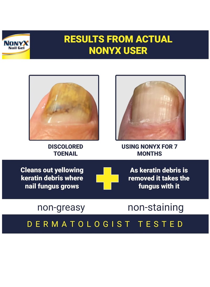 Nonyx Fungal Nail Clarifying Gel Clears Out Keratin Debris  4oz - Image 3
