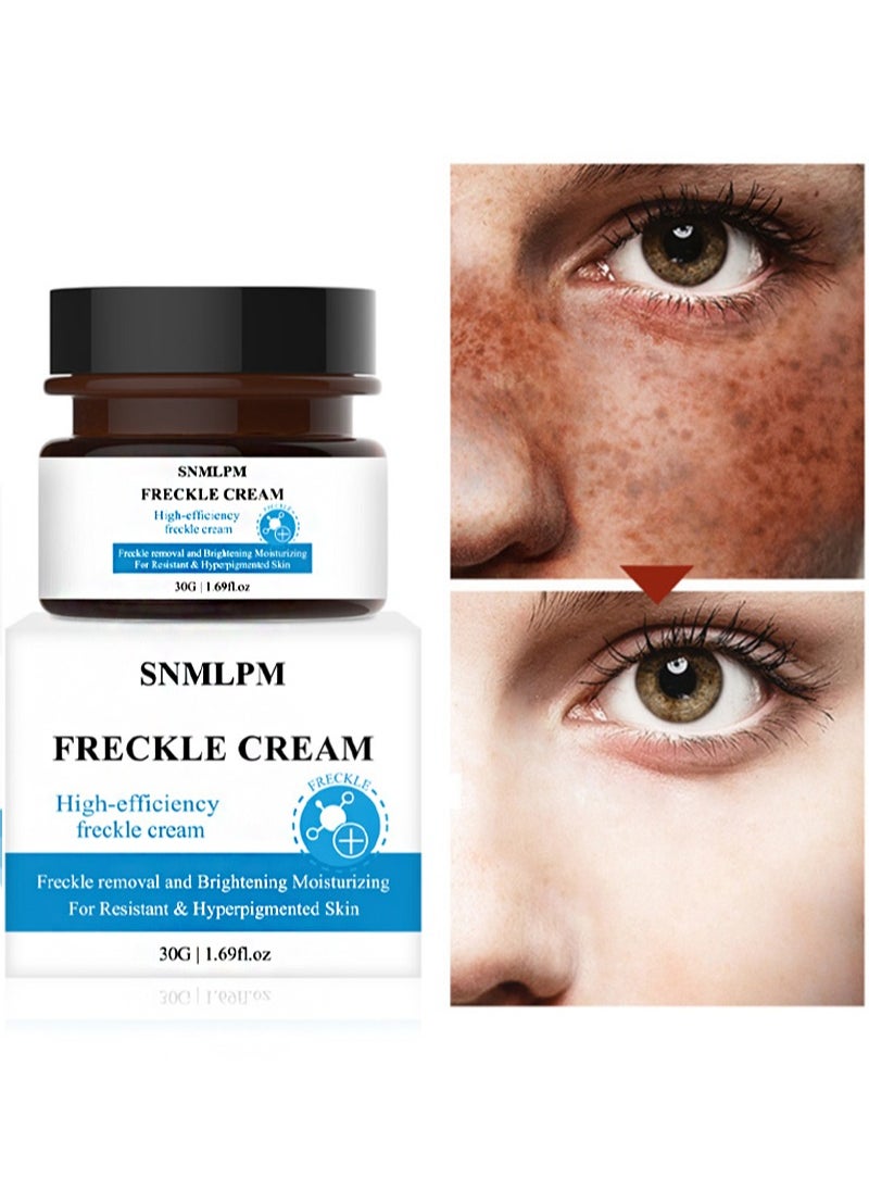 SNMLPM - Freckle Cream,High-efficiency Freckle Cream,Freckle Removal and Brightening Moisturizing For Resistant and Hyperpigmented Skin,Remove Melasma Pigment Melanin Acne Spot Dark Spots - Image 1