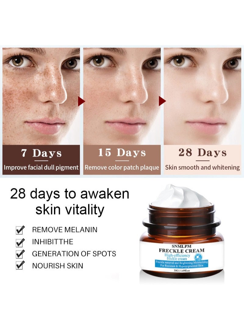 SNMLPM - Freckle Cream,High-efficiency Freckle Cream,Freckle Removal and Brightening Moisturizing For Resistant and Hyperpigmented Skin,Remove Melasma Pigment Melanin Acne Spot Dark Spots - Image 1