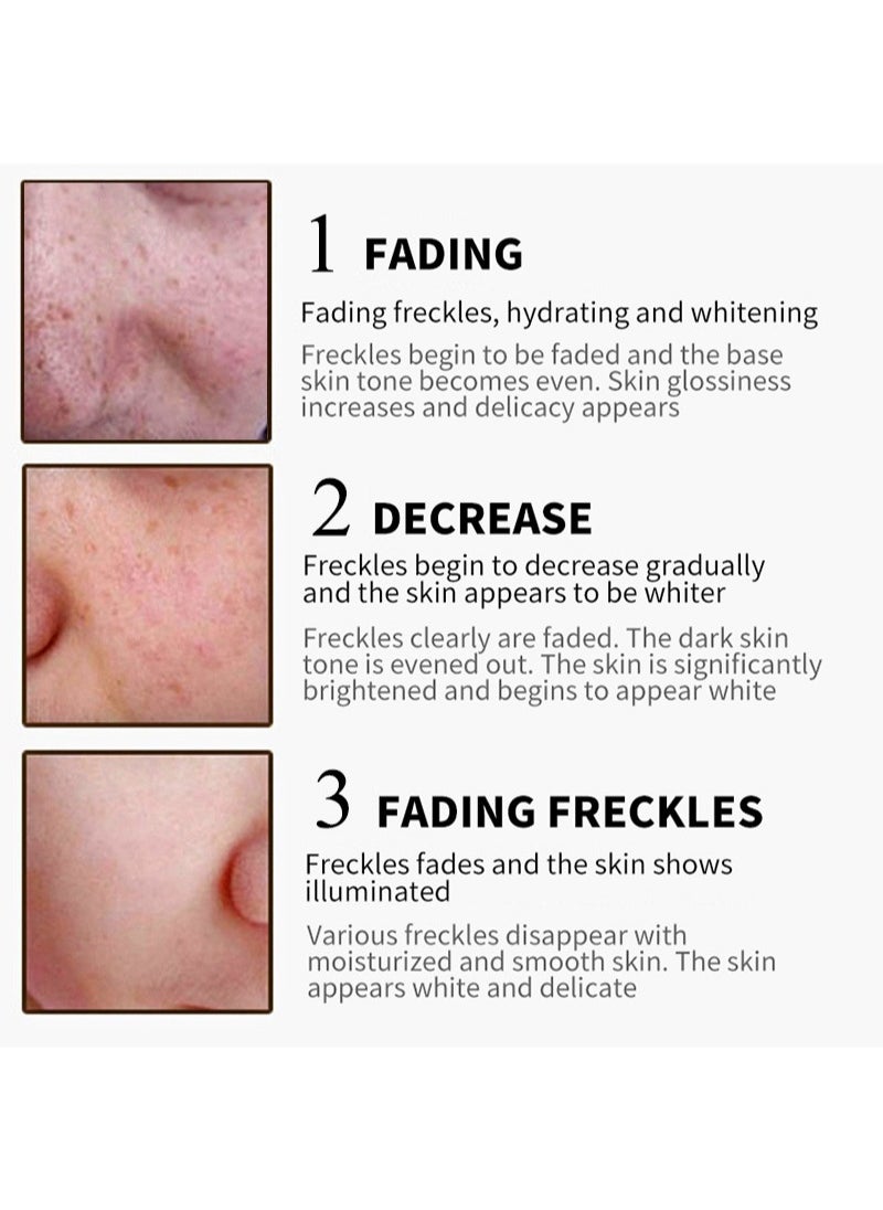 SNMLPM - Freckle Cream,High-efficiency Freckle Cream,Freckle Removal and Brightening Moisturizing For Resistant and Hyperpigmented Skin,Remove Melasma Pigment Melanin Acne Spot Dark Spots - Image 1